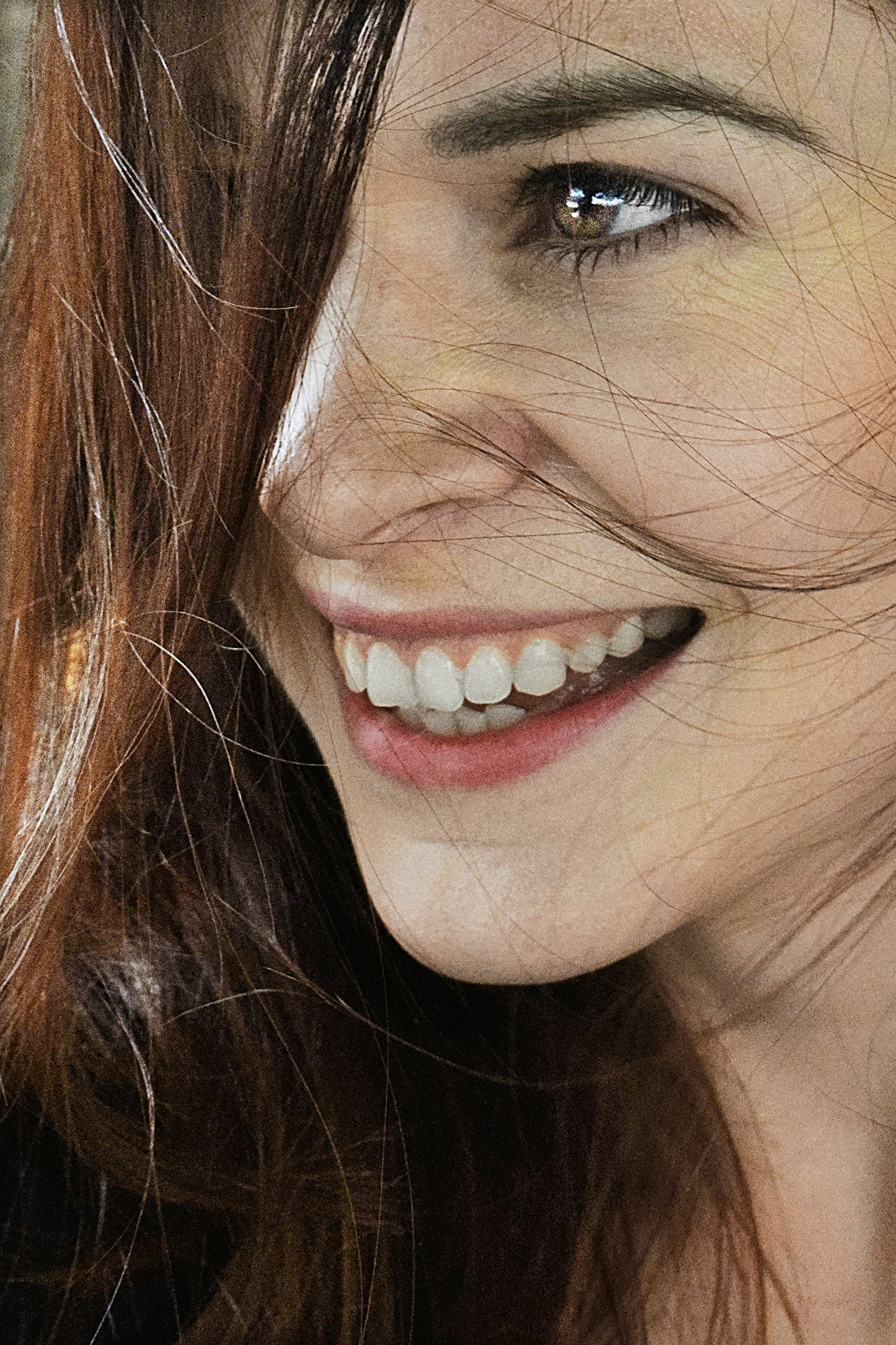 Blanqueamiento dental en Orihuela